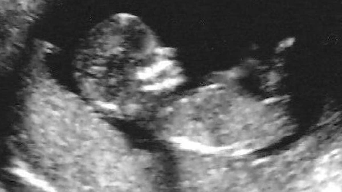 Pro-Life